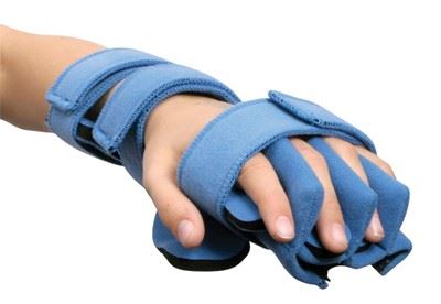 Optimizing Patient Outcomes with Resting Hand Splints