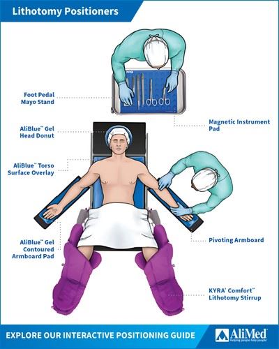 lithotomy patient positioning guide