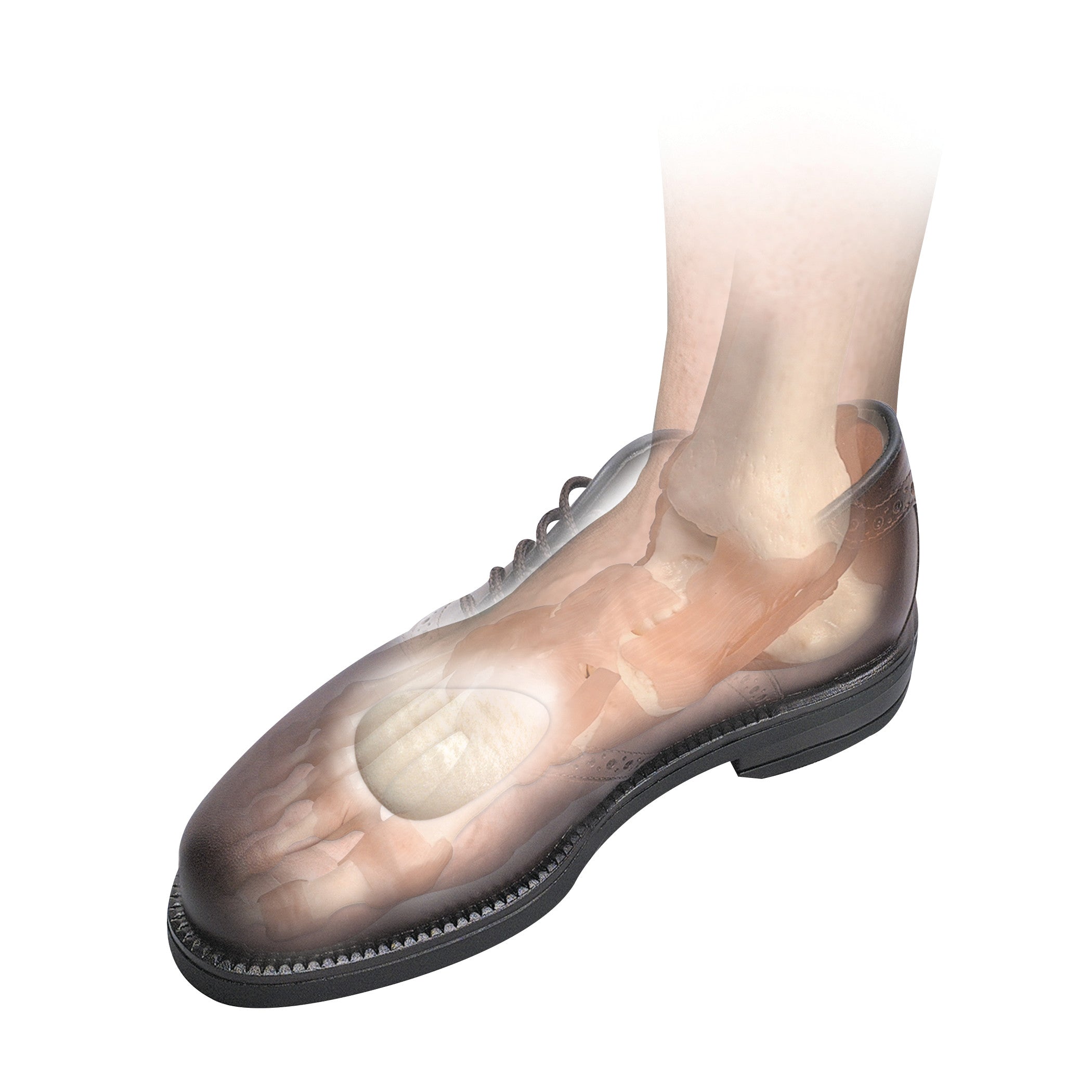 An X-ray illustration of a foot in a transparent shoe with a Hapad Metatarsal Pad visible under the forefoot area.