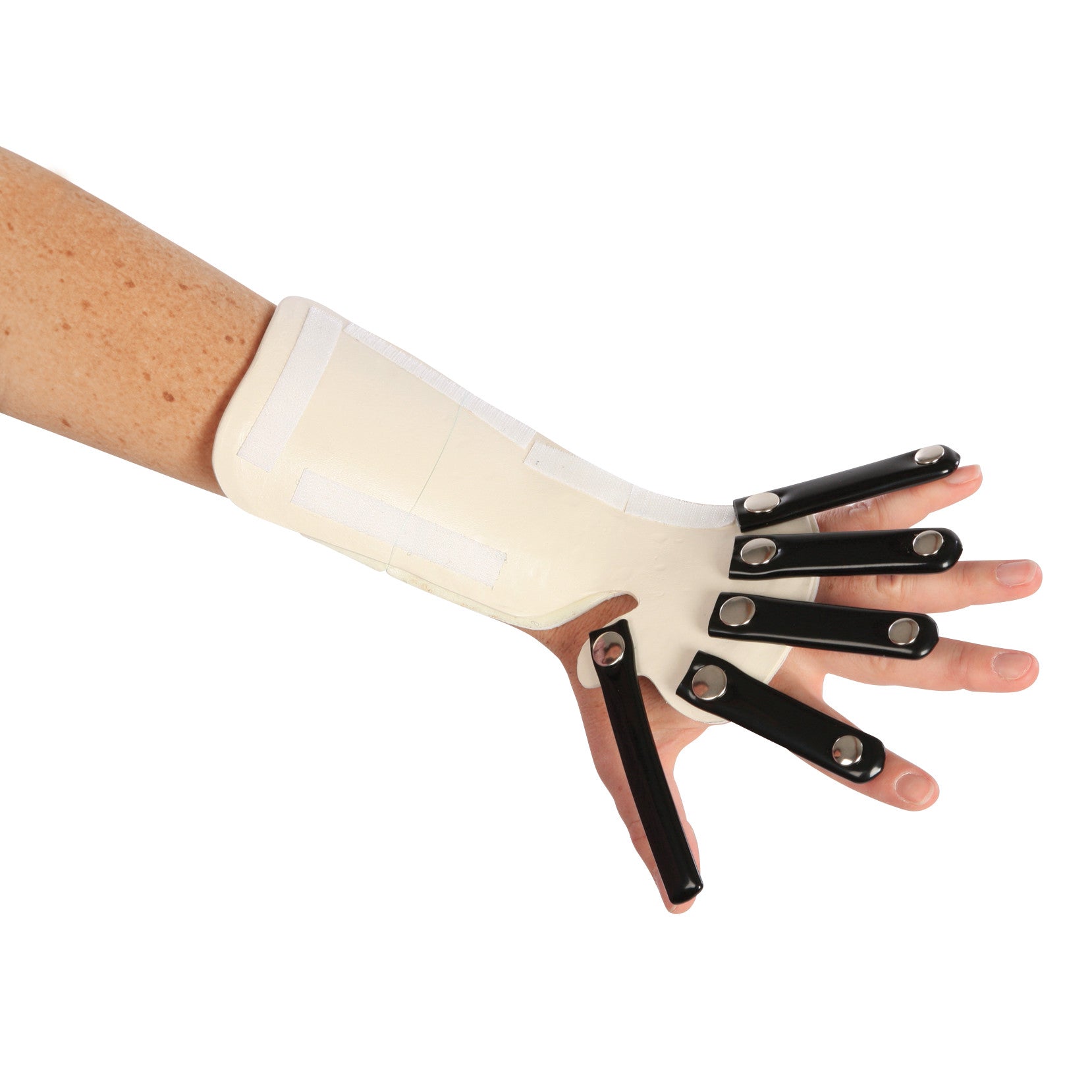 A person's hand wears the AliMed Forearm-Based Radial Nerve Splint, featuring adjustable metal supports for fingers and thumb.