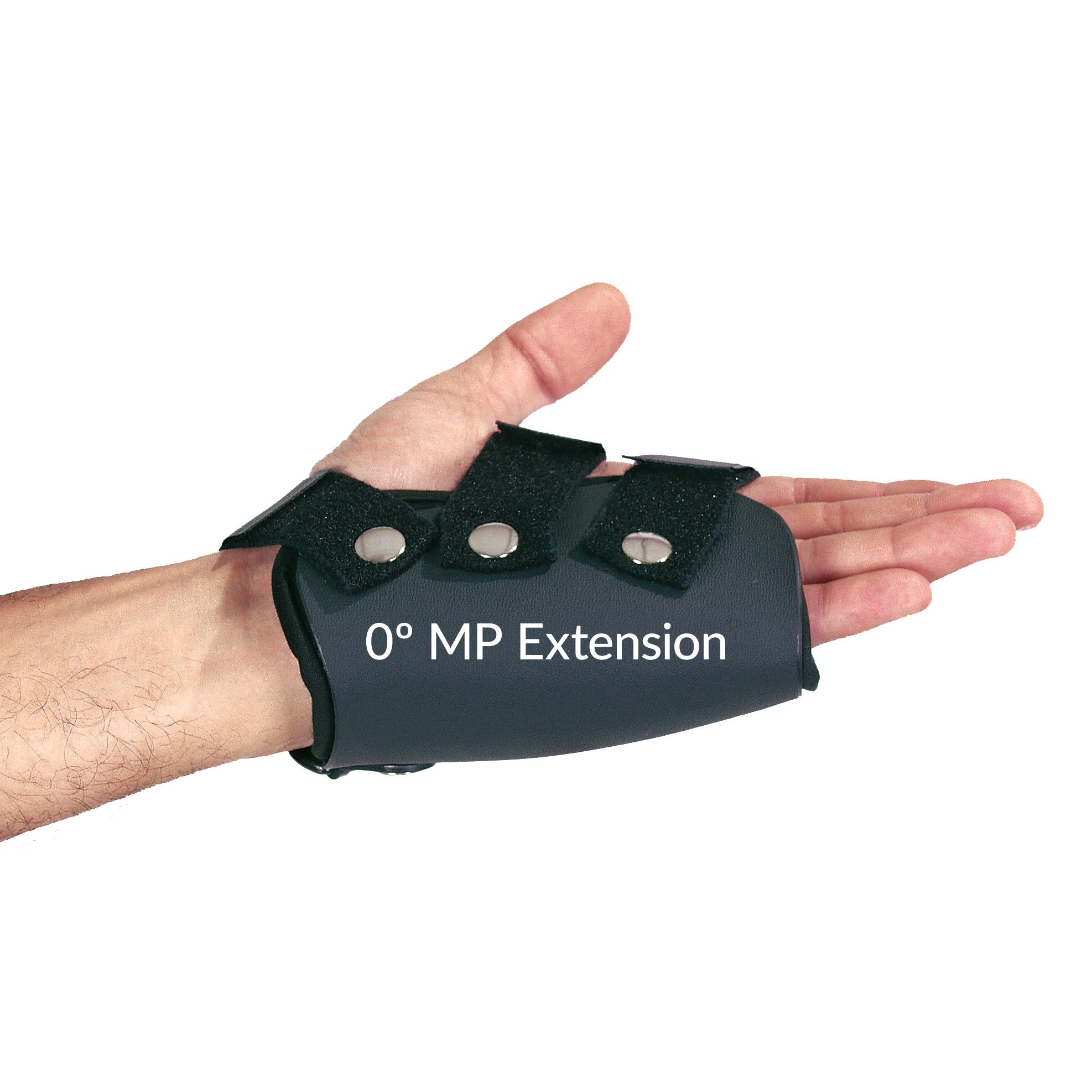 A hand wearing the AliMed FREEDOM comfort Boxer's Fracture Orthoses with MP Extension. The brace is black with straps and buttons.