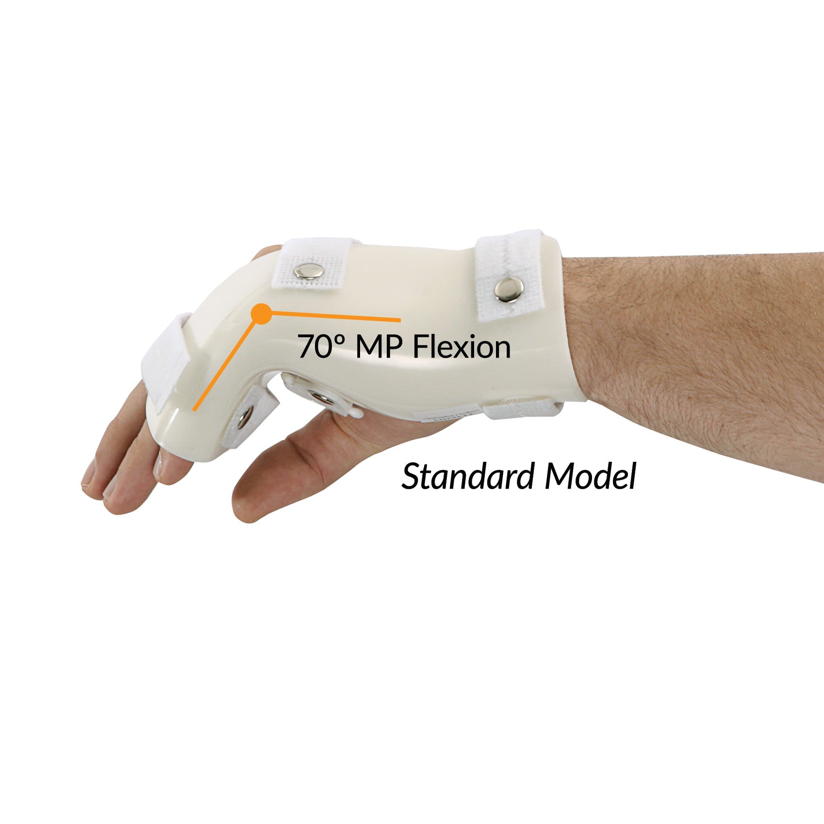 A hand wearing a G-Force Boxers Splint with MP Flexion, showing 70-degree MP flexion, secured with straps.