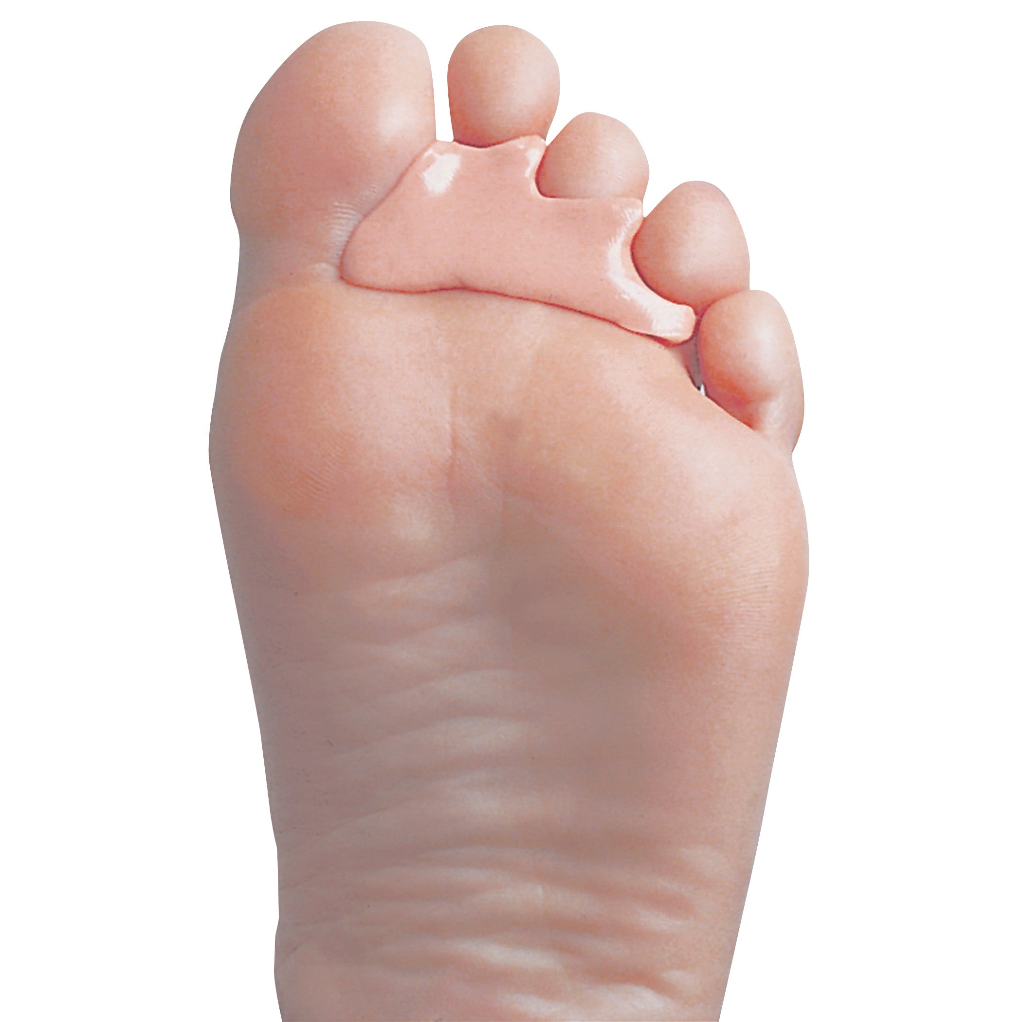 A foot with PediFix PediPlast Moldable Podiatric Compound applied between toes, providing cushioning and support.